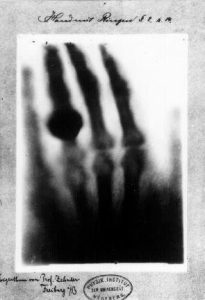 636135006452711698-hand-photo